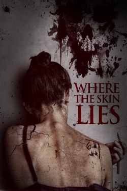 Watch Free Where the Skin Lies Full Movies HD Online MyFlixer