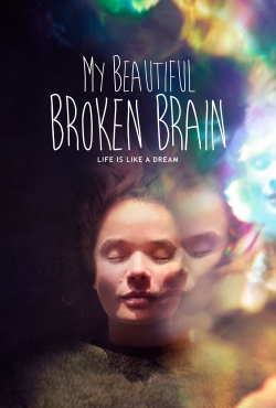 Watch Free My Beautiful Broken Brain Full Movies HD Online MyFlixer